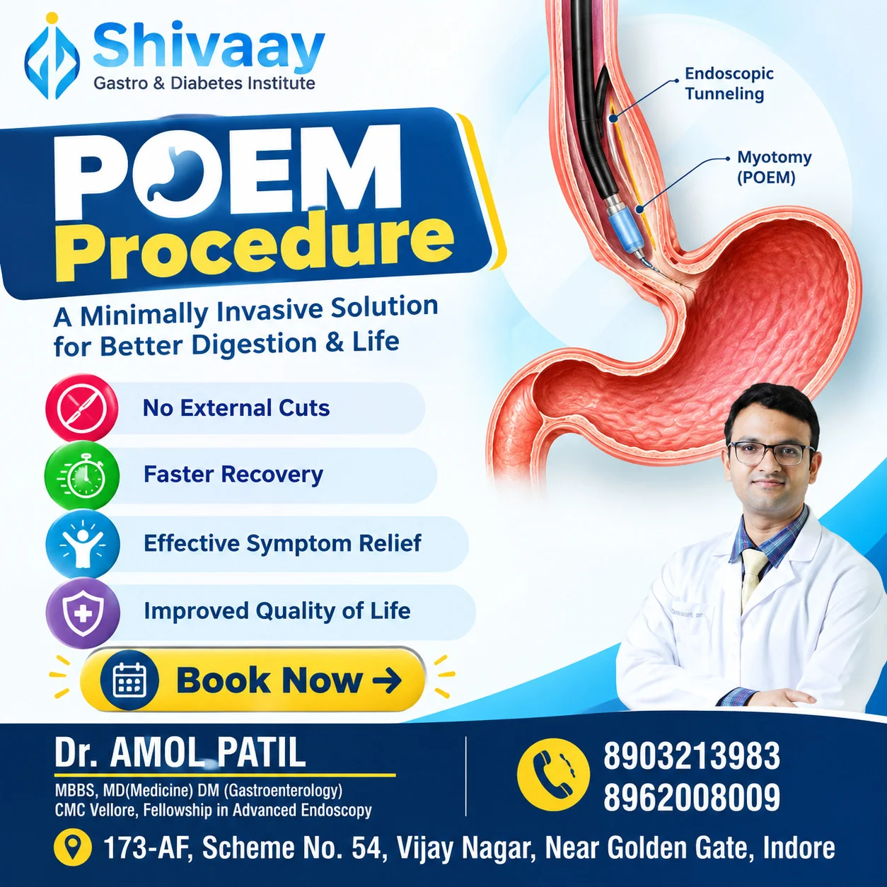 POEM Procedure in Indore